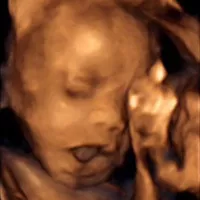 大畸形筛查可以查出胎儿所有的畸形吗？