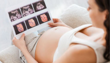 孕期这三次B超畸形筛查很重要，别漏查 
